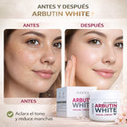 Arbutin White - Crema Aclarante