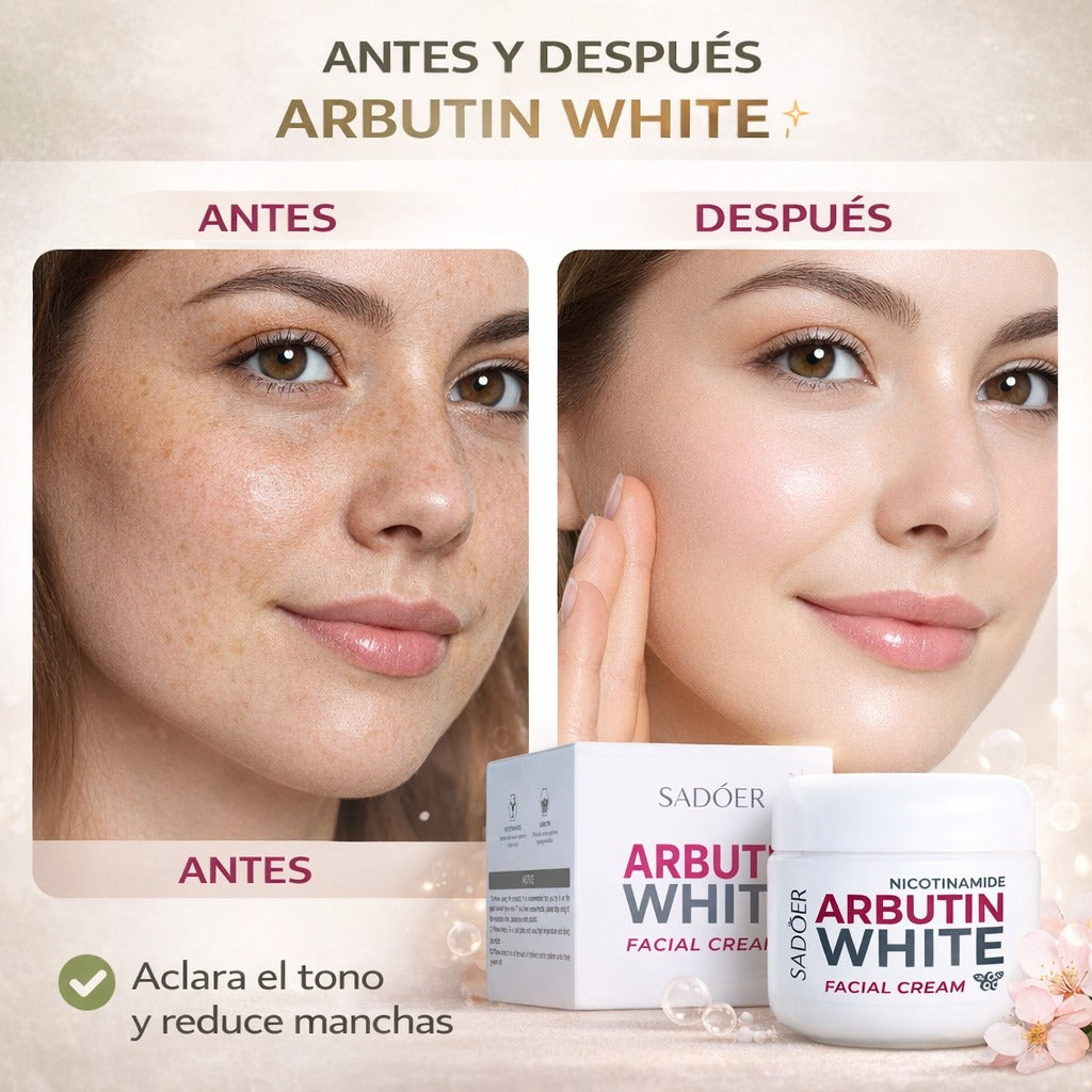 Arbutin White - Crema Aclarante
