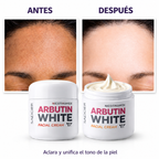 Arbutin White - Crema Aclarante