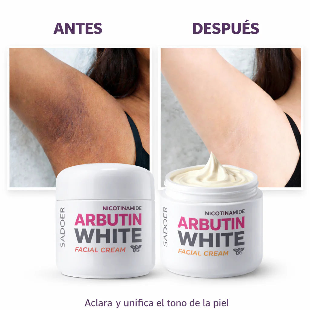 Arbutin White - Crema Aclarante