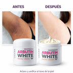 Arbutin White - Crema Aclarante