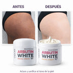 Arbutin White - Crema Aclarante