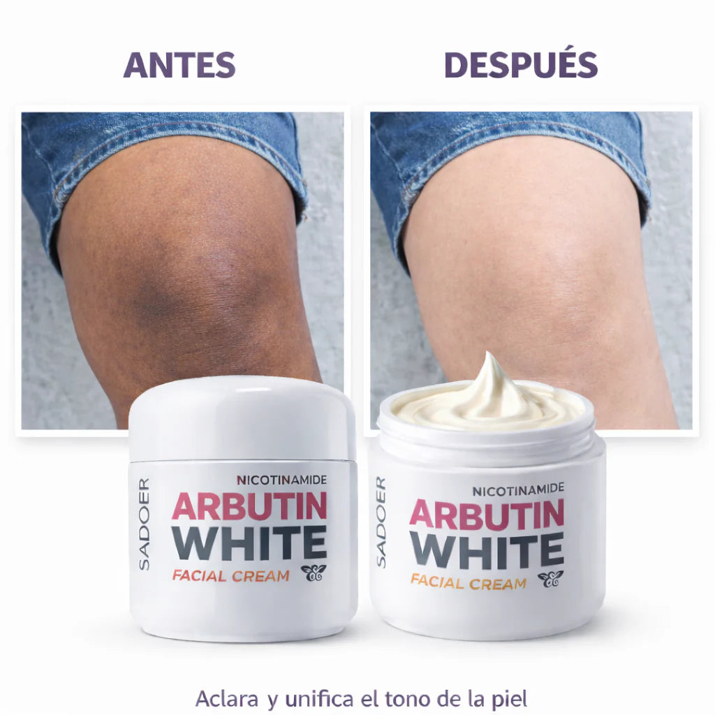 Arbutin White - Crema Aclarante