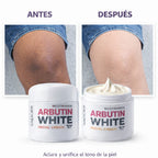 Arbutin White - Crema Aclarante