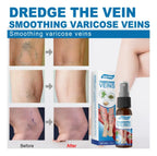 ADIOS VENAS SPRAY(2)