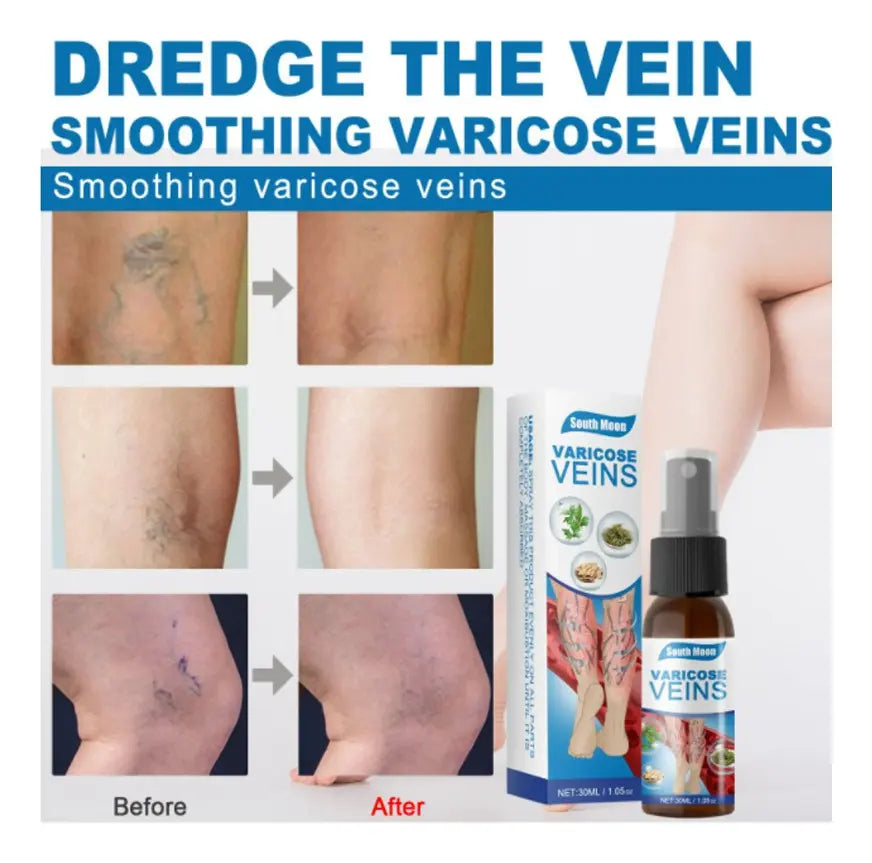ADIOS VENAS SPRAY(2)