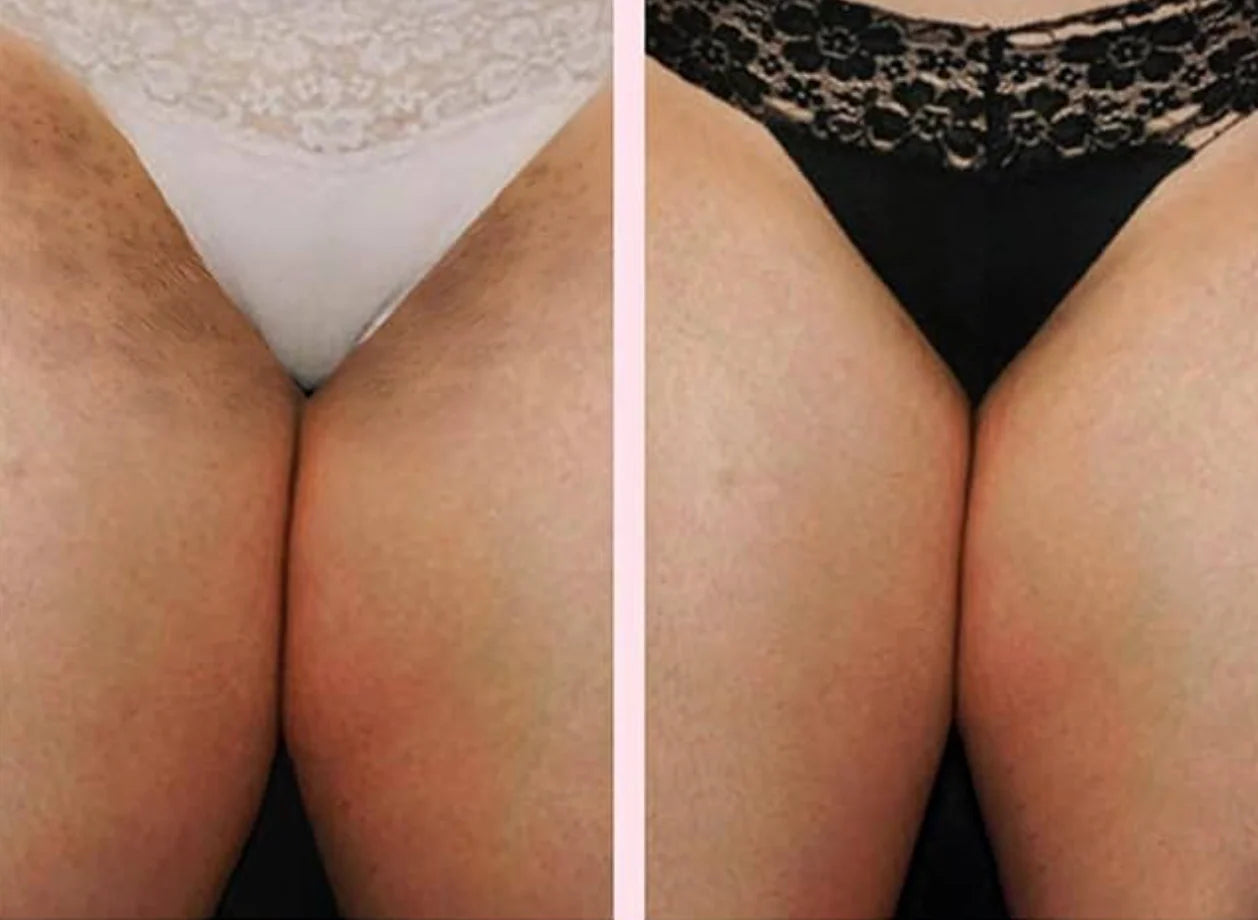 Arbutin White - Crema Aclarante