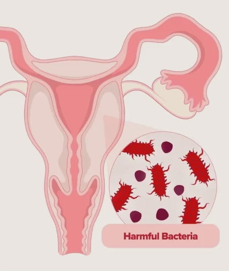 Uro Probiotico Vaginal